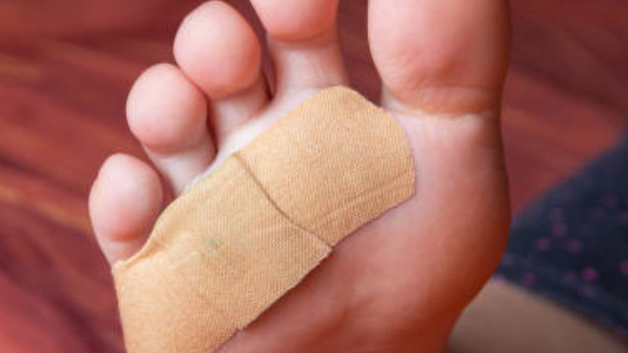 shoe blister